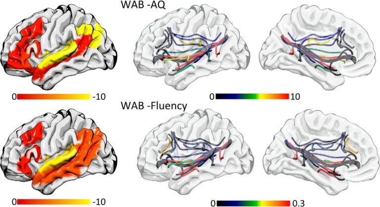 دربارۀ این مقاله بیشتر بخوانید The Language Connectome: How Your Brain’s Neural Highways Power Speech and Understanding